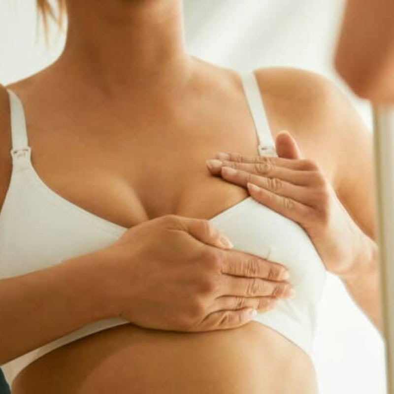What is sad nipple syndrome?