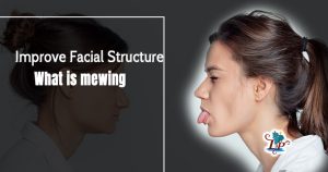 What is mewing